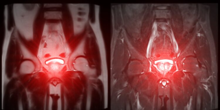 Įgimtos šlapimo sistemos anomalijos: rūšys ir diagnostika