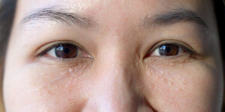 Junginės cista: priežastys, simptomai ir gydymas