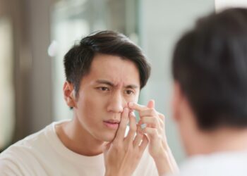 Junginės melanomа: simptomai ir gydymas