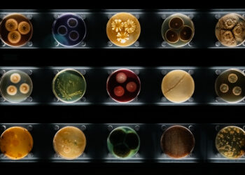 KRE infekcija: priežastys, simptomai, diagnostika ir gydymas