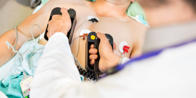 Kardiogeninis šokas: simptomai ir priežastys