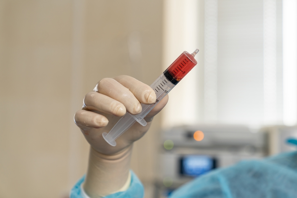 Kaulų čiulpai: kas tai yra ir kodėl jie svarbūs