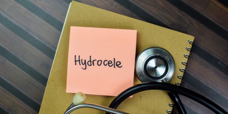 Praeinantis (arba komunikantas) hidročelė: priežastys, simptomai ir gydymas