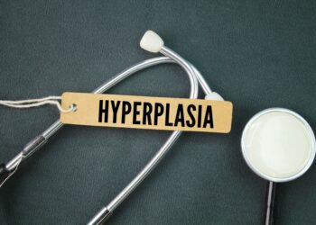 Netipinė latakinė hiperplazija: krūties požymiai ir gydymas