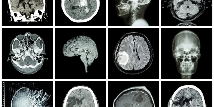Bazaliniai ganglijai: sandara, funkcijos ir reikšmė