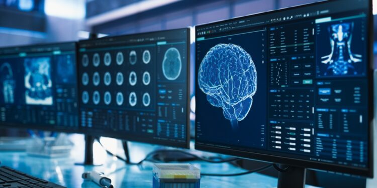 CNS limfoma: simptomai, prognozė ir gydymas