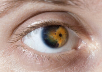 Ragenos distrofija: tipai, simptomai, priežastys ir gydymas