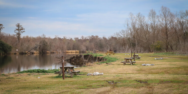 Šarlio Bonė sindromas: Priežastys ir simptomai