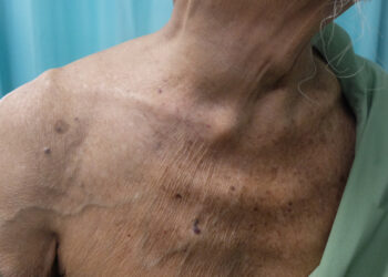 Apatinė tuščioji vena