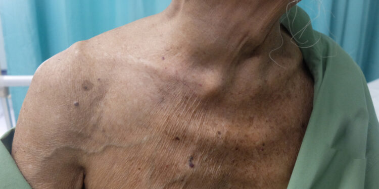 Apatinė tuščioji vena