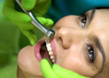 Suskilęs dantis (lūžęs dantis)