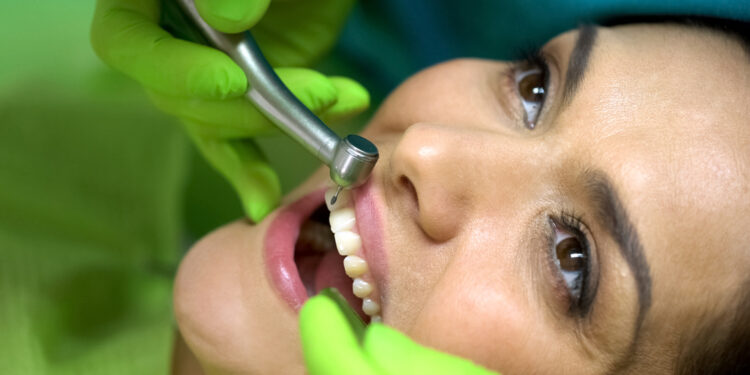 Suskilęs dantis (lūžęs dantis)