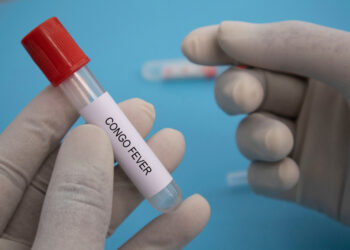 Krymo–Kongo hemoraginė karštligė