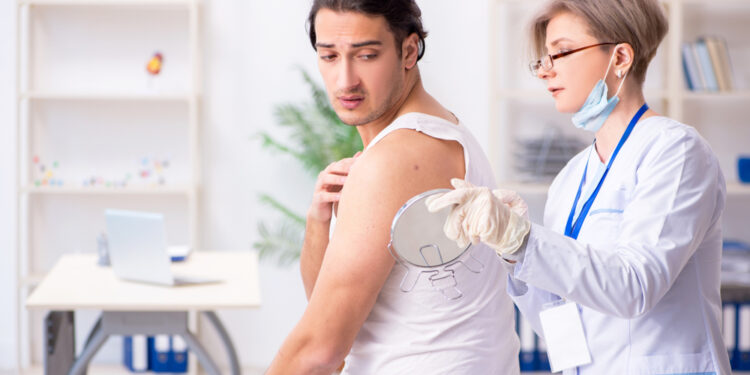 Dysplastic Nevus (Atypical Mole): vs. Melanoma, Stages & RemovalDizplastinis apgamas (atipinis apgamas): palyginimas su melanoma, stadijos ir šalinimas