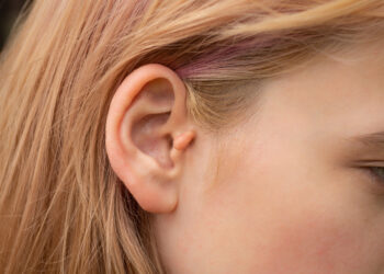 Ausų deformacijos: tipai, priežastys ir gydymas