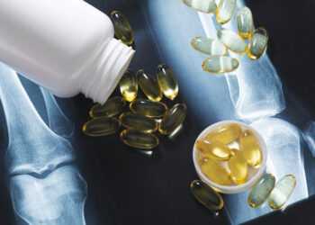 Kelio sąnario kapsulė