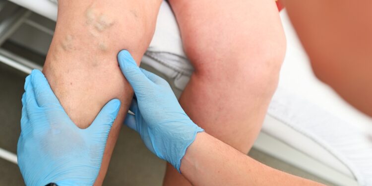 Dizpraksija: kas tai, priežastys, simptomai, diagnozė ir gydymas