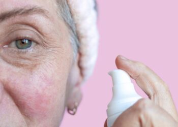 Vynerio išsiplėtusi pora: kas tai, priežastys, simptomai ir gydymas