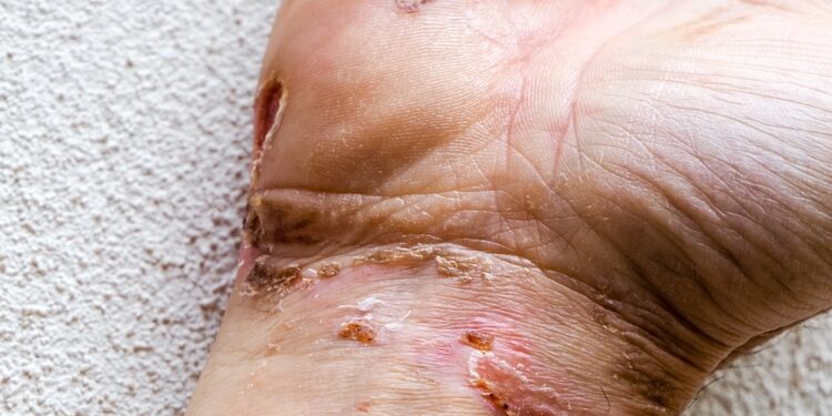 Pirmoji pagalba patyrus elektros smūgį arba sužalojimą elektra