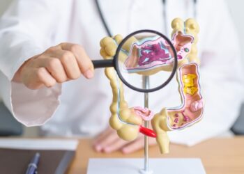 Ar opinis kolitas veikia jūsų savijautą?