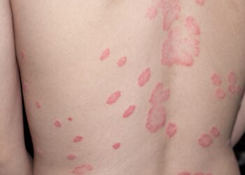 Mano vakaro rutina sergant žvyneline