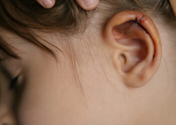 Ausų sužalojimai ir traumos