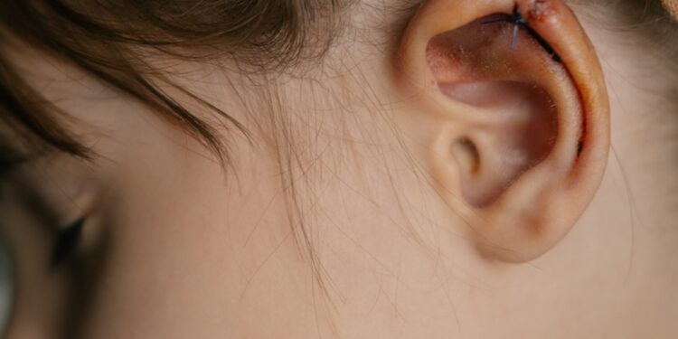 Ausų sužalojimai ir traumos