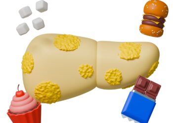 Kaip progresuoja nealkoholinė suriebėjusi kepenų liga?