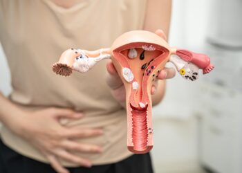 Endometritas: priežastys, simptomai, diagnostika ir gydymas