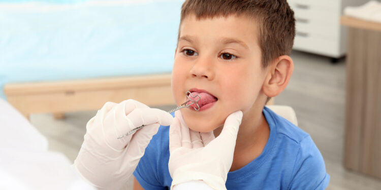 Dizartrija (neryški kalba): simptomai, priežastys ir gydymas