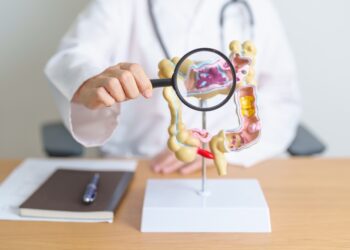 Storųjų žarnų polipai: simptomai, priežastys, rūšys ir šalinimas