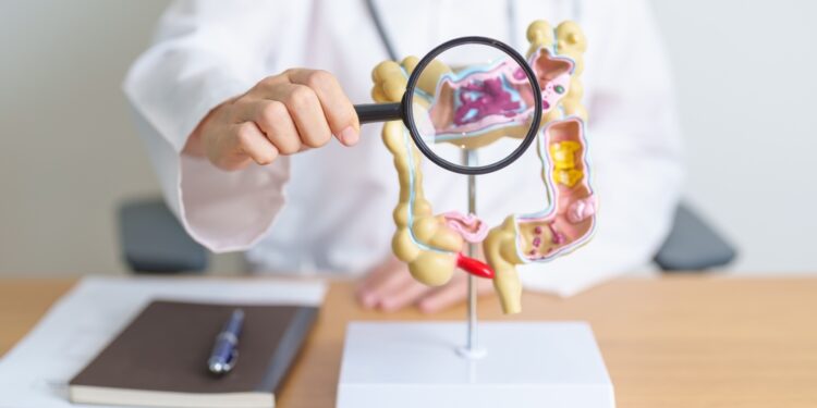 Storųjų žarnų polipai: simptomai, priežastys, rūšys ir šalinimas