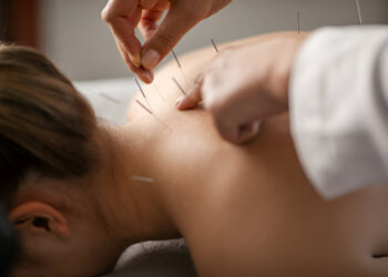 Migrenos malšinimui galintys padėti spaudimo taškai