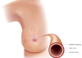 Pieninių latakų išsiplėtimas: priežastys, simptomai ir gydymas