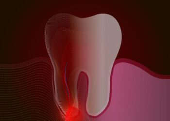 Mukocelė (burnos gleivinės cista): simptomai, priežastys ir gydymas