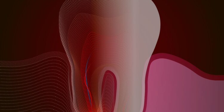 Mukocelė (burnos gleivinės cista): simptomai, priežastys ir gydymas