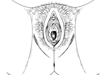 Himeno ataugos ir polipai: priežastys, diagnostika ir šalinimas