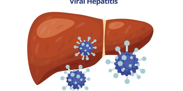 Hepatitas E (HEV): priežastys, simptomai, gydymas ir profilaktika