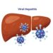 Hepatitas E (HEV): priežastys, simptomai, gydymas ir profilaktika