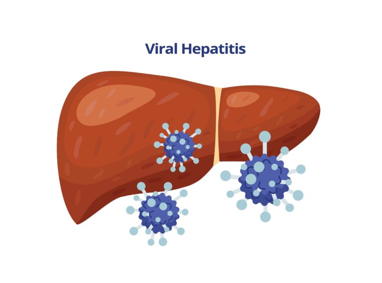 Hepatitas E (HEV): priežastys, simptomai, gydymas ir profilaktika