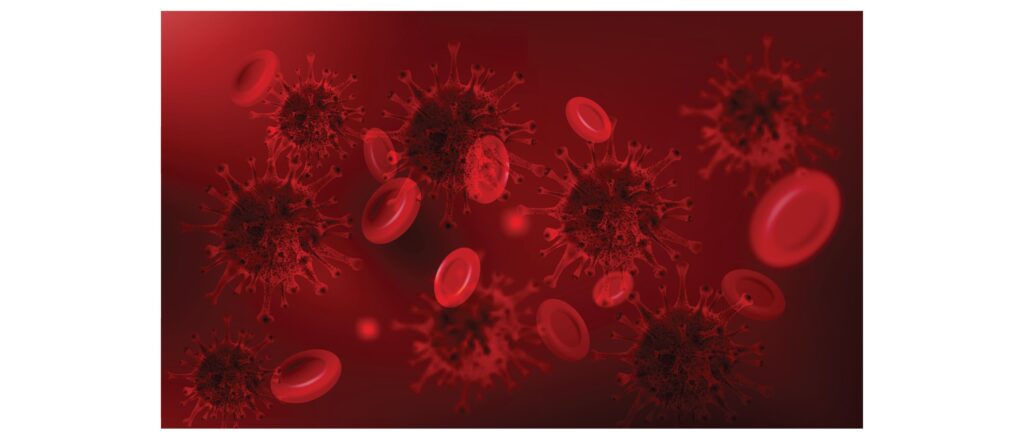 Paroksizminė naktinė hemoglobinurija (PNH): simptomai ir gydymas