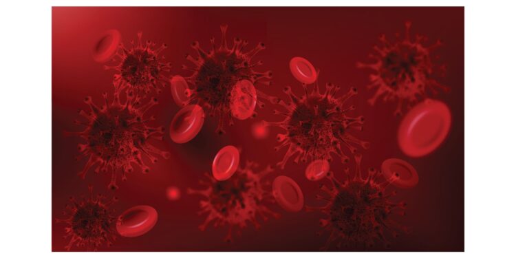 Paroksizminė naktinė hemoglobinurija (PNH): simptomai ir gydymas