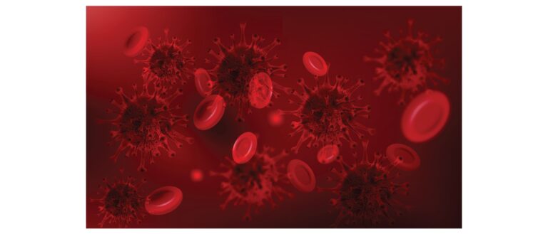 Paroksizminė naktinė hemoglobinurija (PNH): simptomai ir gydymas