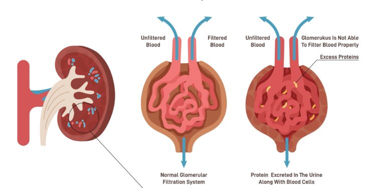 Echinokokozė: Priežastys, simptomai ir gydymas