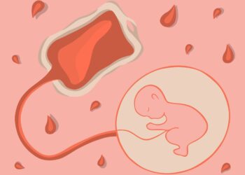 Širdies plakimo sutrikimai nėštumo metu: priežastys ir gydymo galimybės