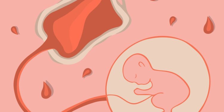 Širdies plakimo sutrikimai nėštumo metu: priežastys ir gydymo galimybės