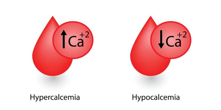 Hiperkalcemija: kas tai, priežastys, simptomai ir gydymas