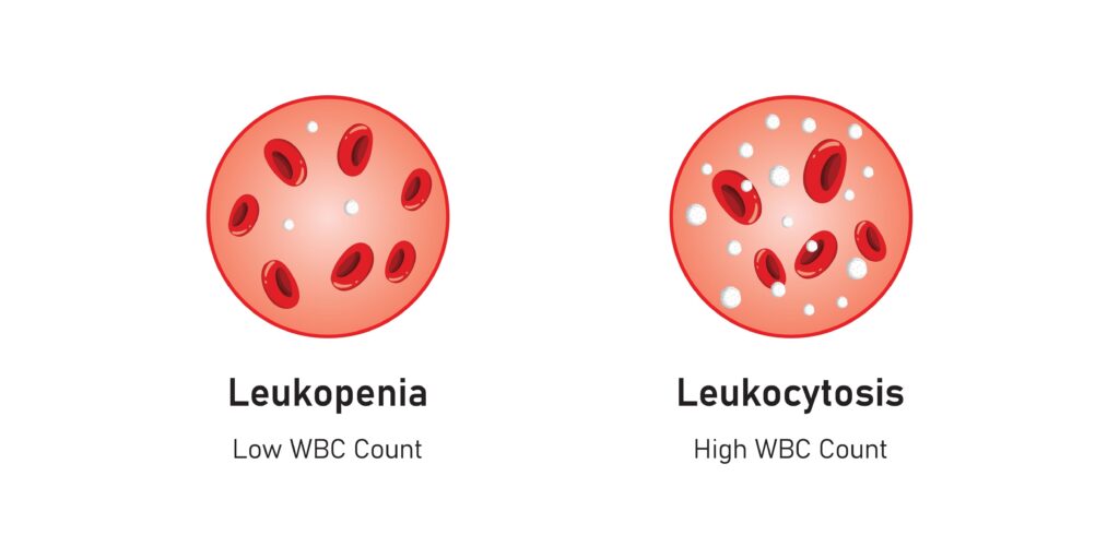 Hemofagocitinė limfohistiocitozė: simptomai, priežastys ir prognozė