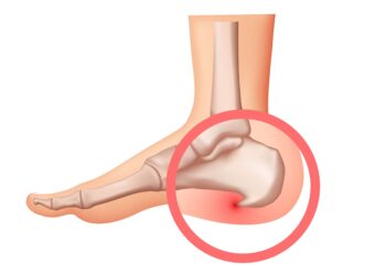 Kulno ataugos: simptomai, priežastys ir gydymas