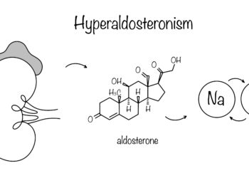 Hiperaldosteronizmas: kas tai, priežastys, simptomai ir gydymas
